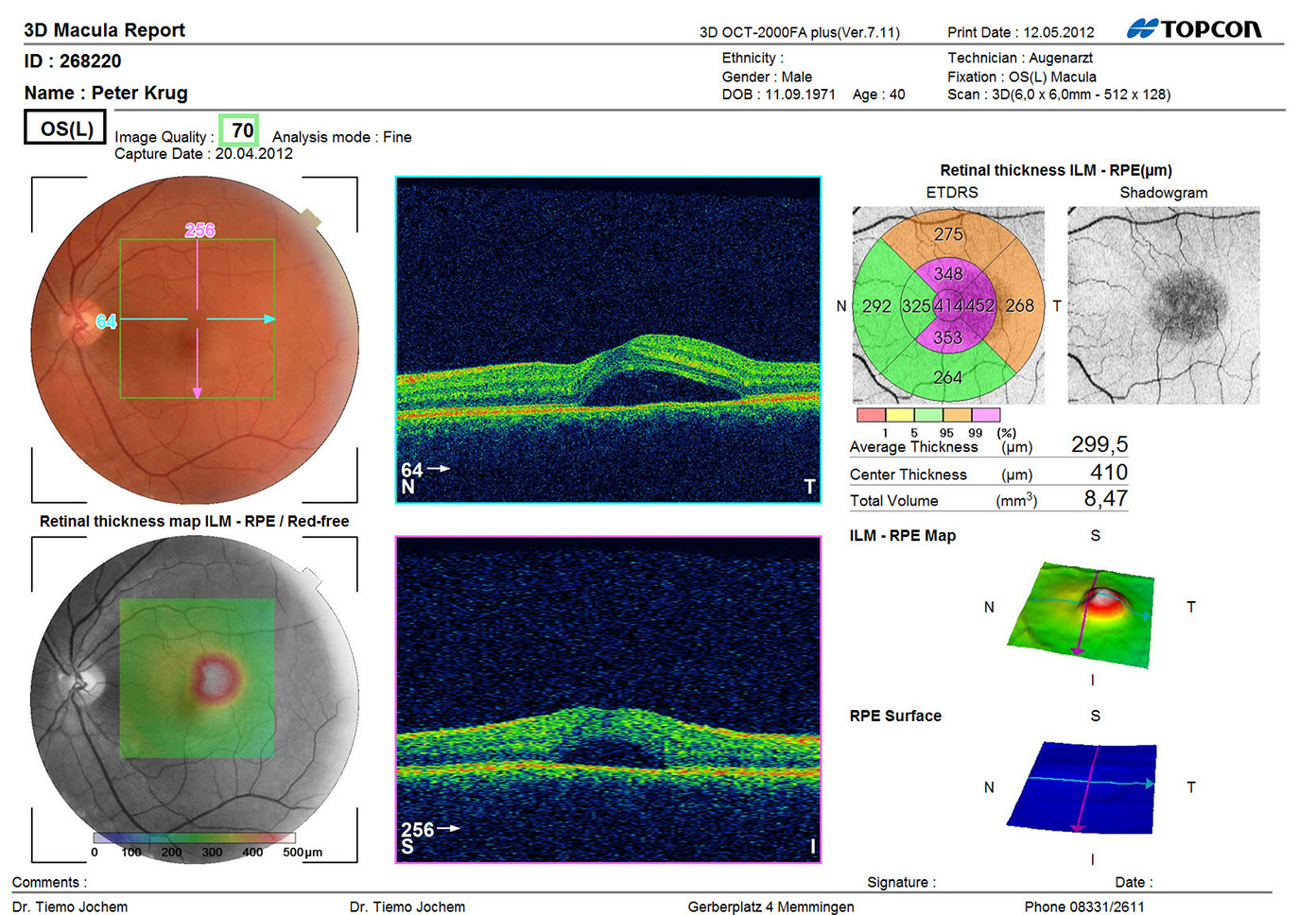 Dr. Jochem Augenärzte Memmingen Makula